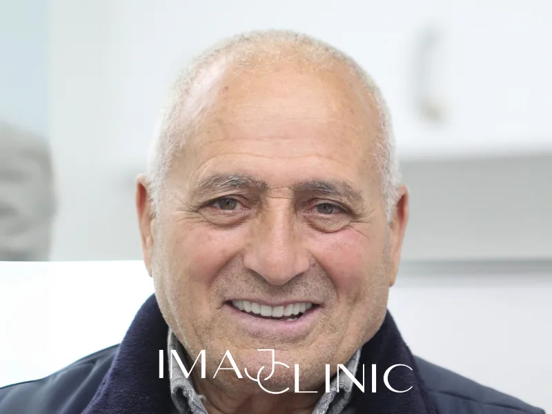 Tedavi sonrası vaka 21
