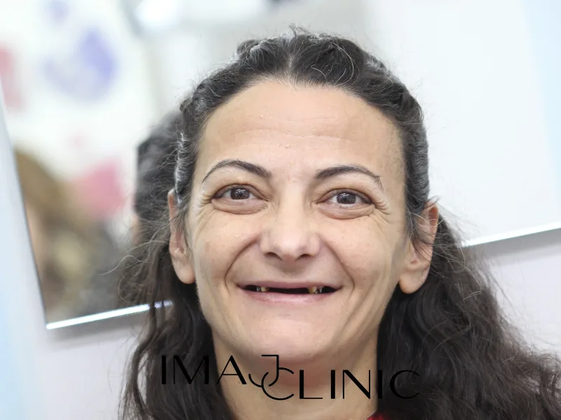 Tedavi öncesi vaka 15