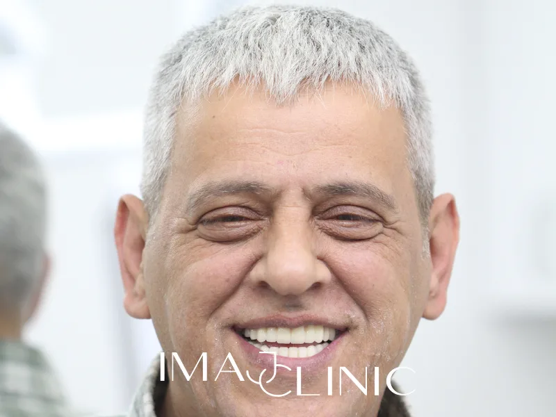 Tedavi sonrası vaka 19