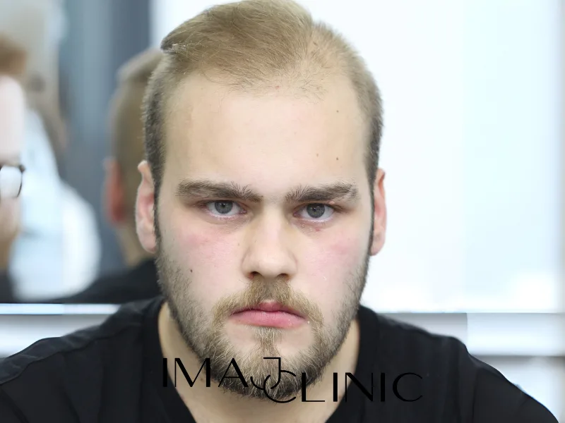 Tedavi öncesi vaka 16