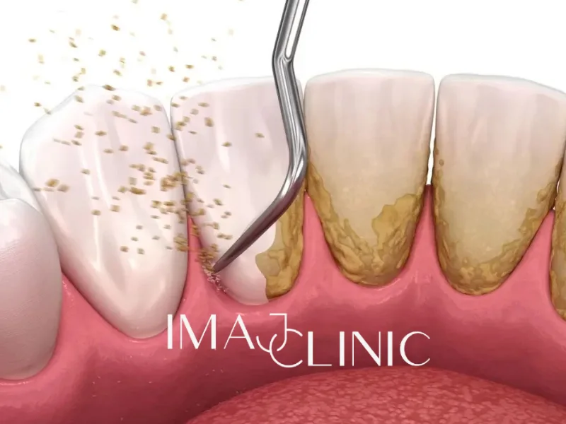 Periodontoloji
