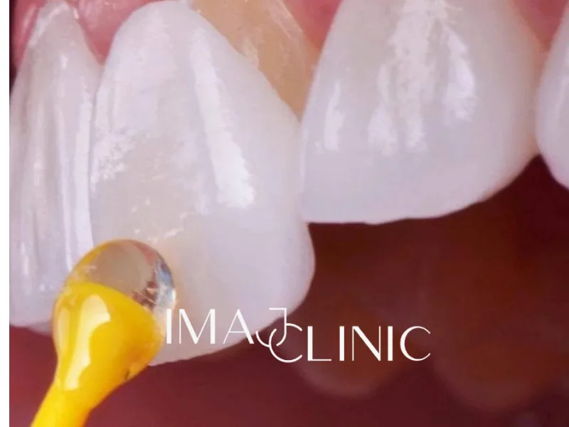 Yaprak Porselen görseli